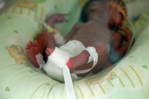 Дариха специализирани пелени за недоносени бебета на Неонатологията в Русе