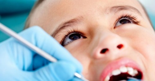 Безплатно поставяне на силанти на първите постоянни зъби при децата