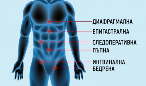 Безплатни профилактични прегледи при хирург в ДКЦ Света София - Люлин